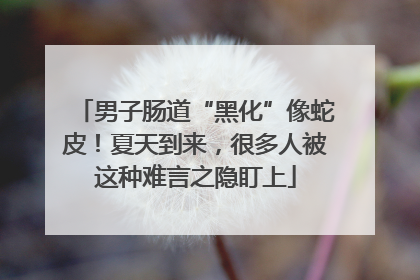 男子肠道“黑化”像蛇皮！夏天到来，很多人被这种难言之隐盯上