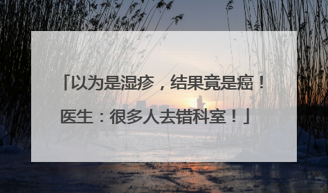 以为是湿疹，结果竟是癌！医生：很多人去错科室！